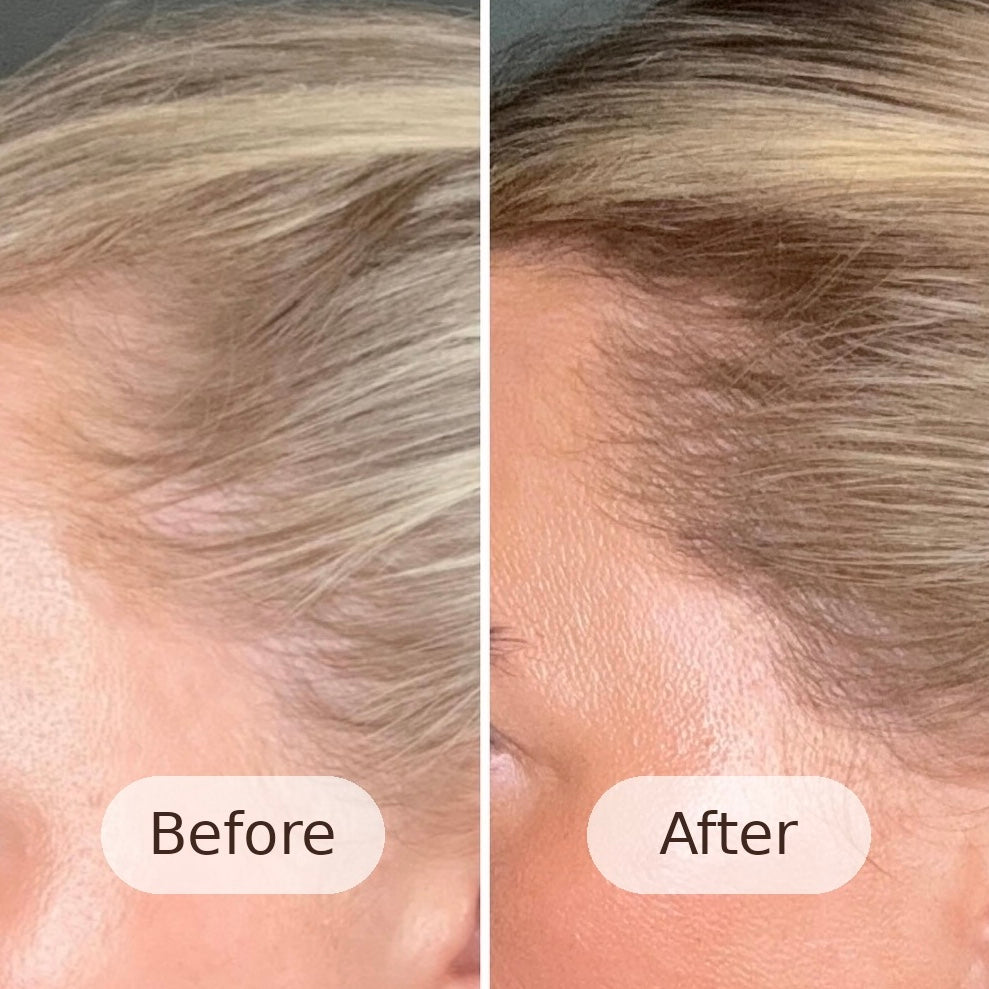 RIVA FILTERED SHOWER HEAD