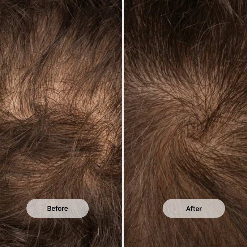 RIVA FILTERED SHOWER HEAD