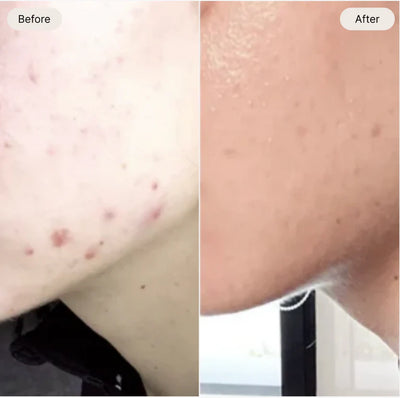 Source of my unclear skin