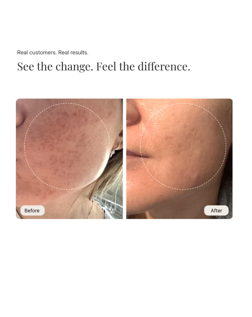 RIVA REPLACEMENT FILTER