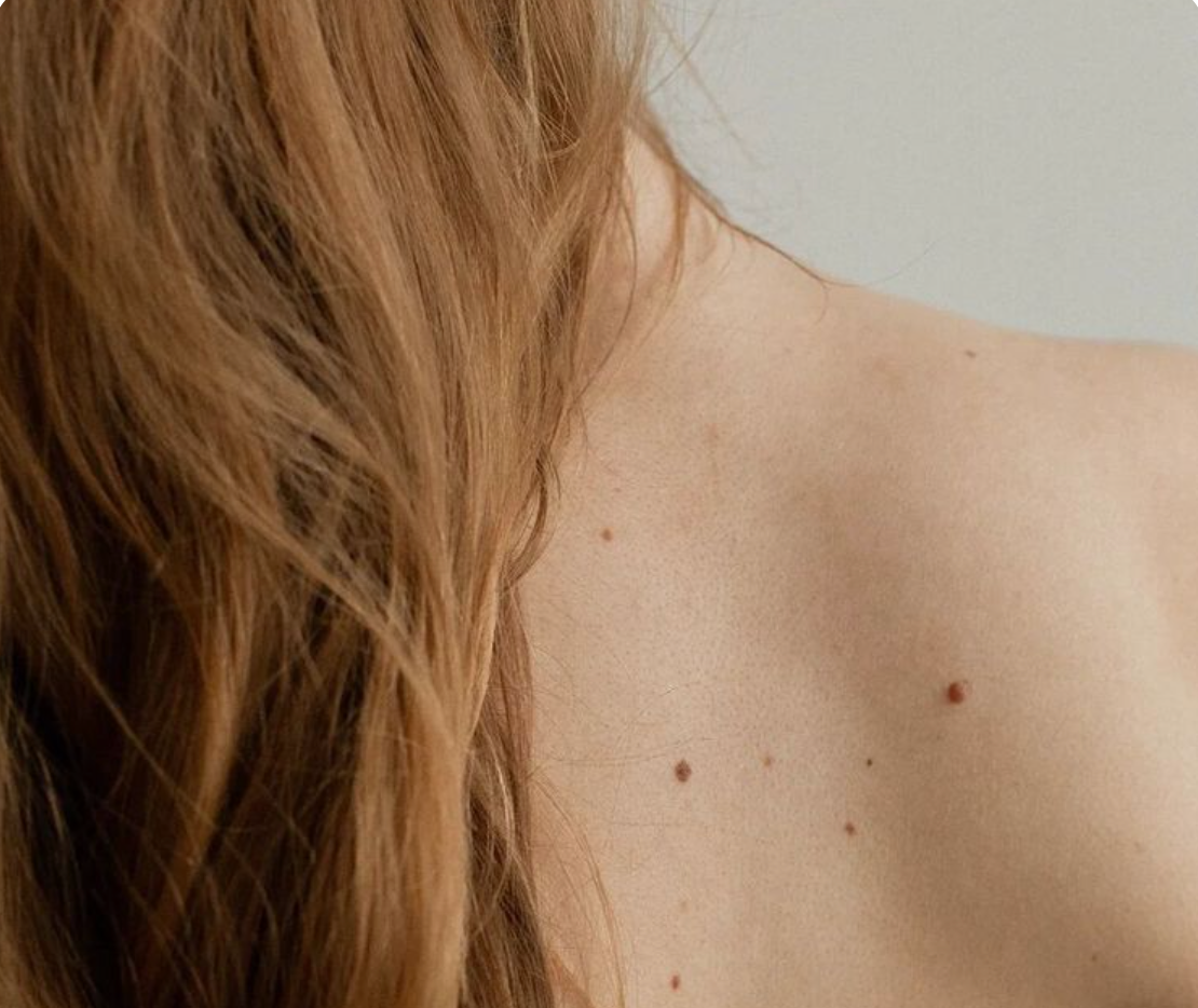 Skin effects illustration